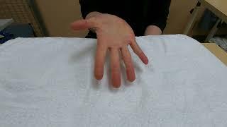 Hand injury exercise 1: Active full finger bending and straightening (flexion and extension)