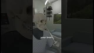 Lobotomy  (explained)