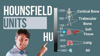 Hounsfield Units (Where do CT numbers come from?)