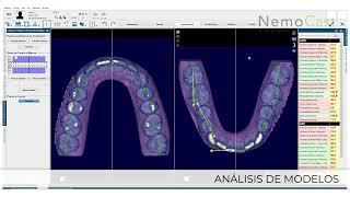 Demo NemoCast - El mayor avance en odontología digital_Español