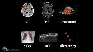 One-click segmentation in medical imaging - by RSIP Vision