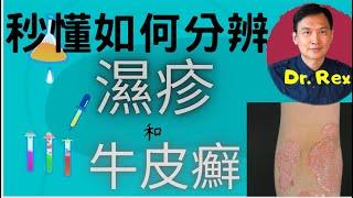 (中英字幕Engsub) 秒懂分辨濕疹和牛皮癬 How to tell if a rash is caused by psoriasis or eczema?