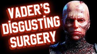 The HORRIFYING Surgery Anakin Went through to become Vader! (Star Wars Explained)