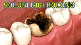 Bukan DICABUT bukan DITAMBAL‼️ Ini solusi GIGI BERLUBANG‼️