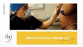 What's involved in a Mastopexy?