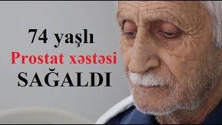 İllərdir Prostat xəstəliyindən əziyyət çəkirdi - Belə sağaldı