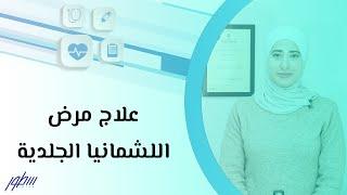 علاج مرض اللشمانيا الجلدية