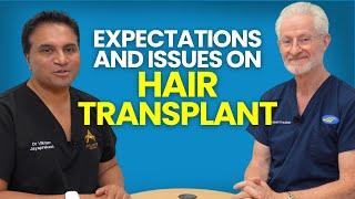 Common Issues with Hair Transplantation and What to Expect