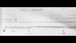 Frog’s Cardiogram & Effect of Temperature