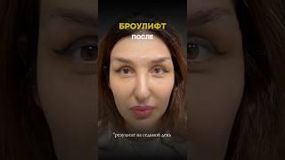 Результат броулифта спустя неделю 