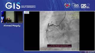 Ahmed Magdy- My Most Educational Cases of ACS from the Masters