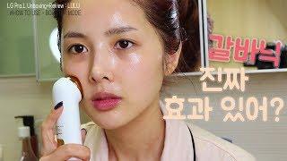 진짜 효과 있을까? 갈바닉 사용법, 2주 사용기! 뷰티디바이스 후기 (LG Pra.L Galvanic Ion Booster 프라엘 갈바닉 이온부스터) │ 첼라chela