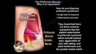 The Piriformis syndrome causes and diagnosis - Everything You Need To Know - Dr. Nabil Ebraheim