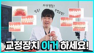 나에게 맞는 치아교정 장치? 딱 정해드립니다!