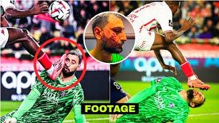 FOOTAGE & UPDATE! Psg Goalkeeper Gianluigi Donnarumma horrible injury vs Monaco