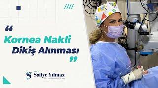 Kornea Nakli Dikiş Alınması | Prof. Dr. Safiye Yılmaz