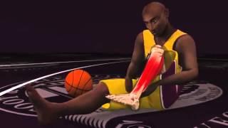 The Painful Moment Kobe Bryant's Achilles Tendon SNAPPED!