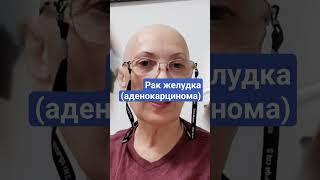 Состояние После Химиотерапии У меня рак желудка