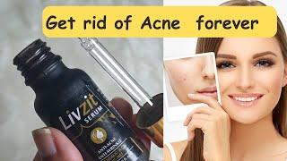 best acne removal serum||anti acne anti wrinkle livzit serum# Glimmmer&glow review#serum #review