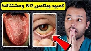 شوکه کننده: کمبود ویتامین B12 چه تاثیر وحشتناکی روی بدن میذاره؟!