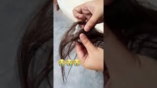 Chewing gum in my Hair ? Balo se Chewing gum kaise nikale,without cutting hair