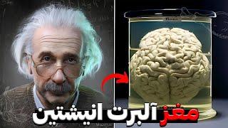 مغز انیشتین چقدر متفاوت بود؟