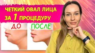 Коррекция овала лица. Топ 3 процедуры для четкого овала лица.