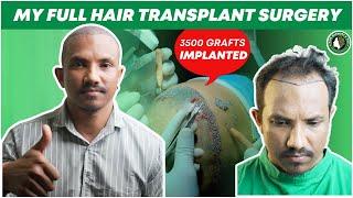 Hair Transplant in Assam | Best Results & Cost of Hair Transplant in Assam