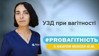 УЗД при вагітності