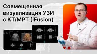 Совмещенная ультразвуковая визуализация (iFusion) с данными КТ/МРТ/ПЭТ