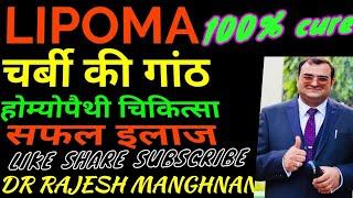 Homeopathic #treatmentoflipoma Discussion and treatment by   #drrajeshmanghnani #ehomeovision