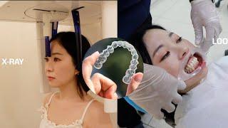 Jina Kim's Invisalign Experience | Seoul Guide Medical