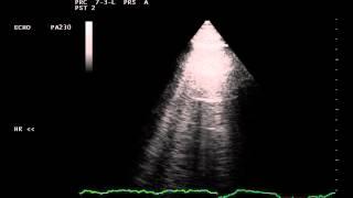 Case of the Month # 1 - Pleural