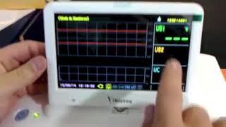 Bistos BT 350 Fetal Monitor - DEMO