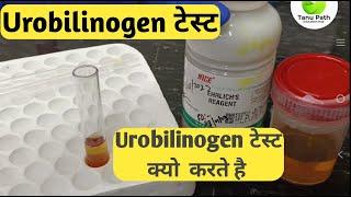 urobilinogen test