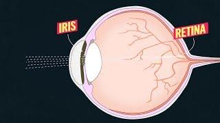 This is why you need special glasses to view the total solar eclipse