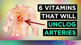 6 Vitamins To UNCLOG Your ARTERIES