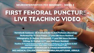 FEMORAL PUNCTURE BASICS FOR CEREBRAL ANGIOGRAPHY# NEUROINTERVENTION SERIES 3#DR AHAMED SUBIR