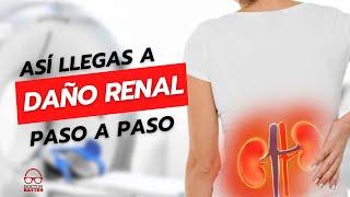 5 PASOS Para LLEGAR A FALLA RENAL  Como Cuidar Nuestros Riñones - Doctor Bayter