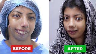The Most Stunning Plastic Surgery Transformation