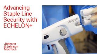 How to Use ECHELON+ Stapler for Advanced Staple Line Security | J&J MedTech