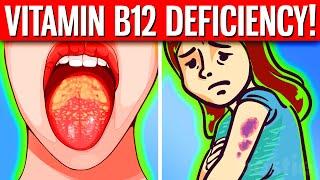 15 VISIBLE Signs You Have Vitamin B12 Deficiency!