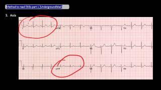 Method to read EKG part 1 [UndergroundMed]