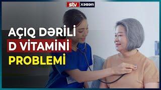 AÇIQ DƏRİLİ İNSANLARDA D VİTAMİNİ PROBLEMİ - STV Xəbər