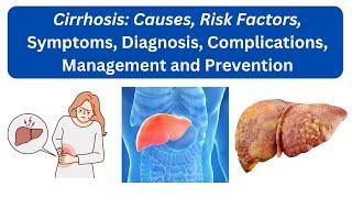 Cirrhosis: Causes, Risk Factors, Symptoms, Diagnosis,  Complications, Management and Prevention