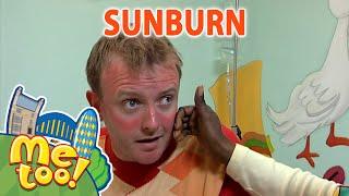 @MeTooOfficialTVShow | ️ Sunburn ️ | #FullEpisode | SUMMER | TV Show For Kids