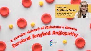 Dr Clíona Farrell - A vascular element of Alzheimer’s: Cerebral Amyloid Angiopathy