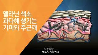 멜라닌 색소 과다해 생기는 기미와 주근깨 - (20150729_551회 방송)_내 몸에 쌓이는 자외선, 여름 햇빛을  차단하라