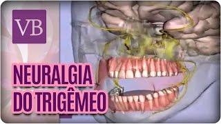 O que é Neuralgia do Trigêmeo  - Você Bonita (18/01/17)