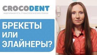   Элайнеры или брекеты - отличия, правила ухода, что лучше. Элайнеры или брекеты что лучше. 12+